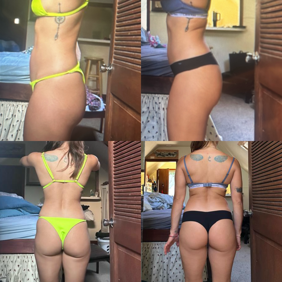 Transformation