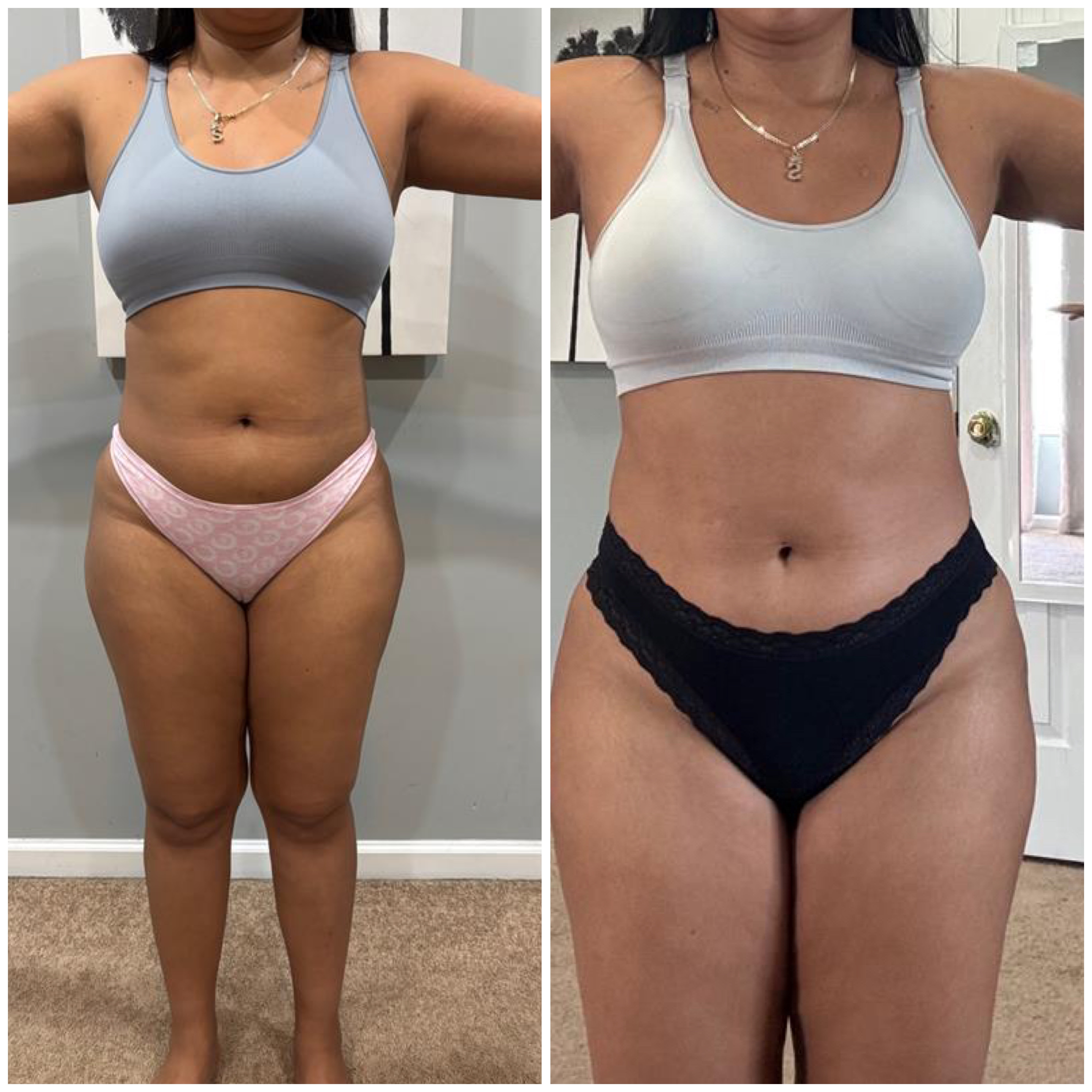 Transformation