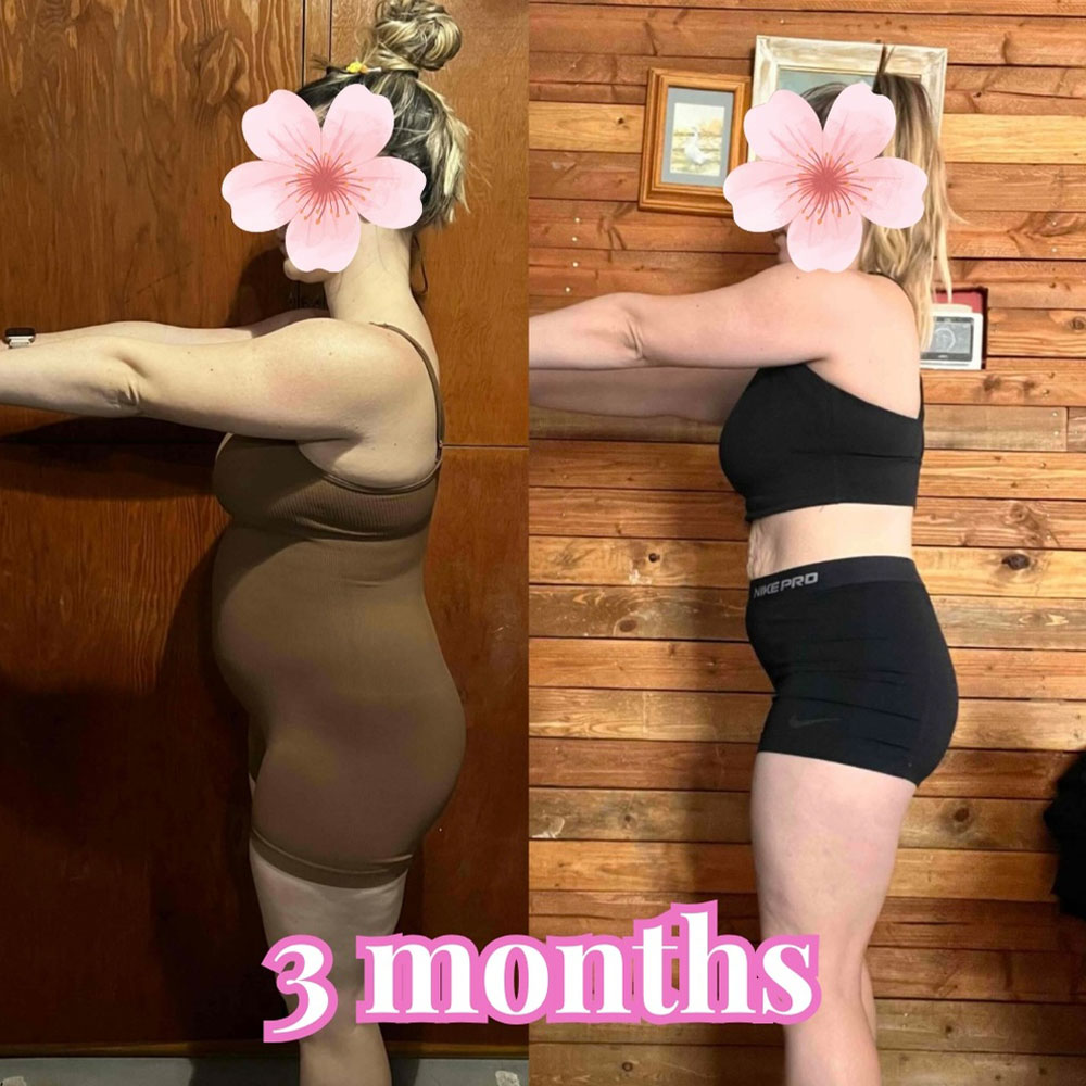 Transformation 1