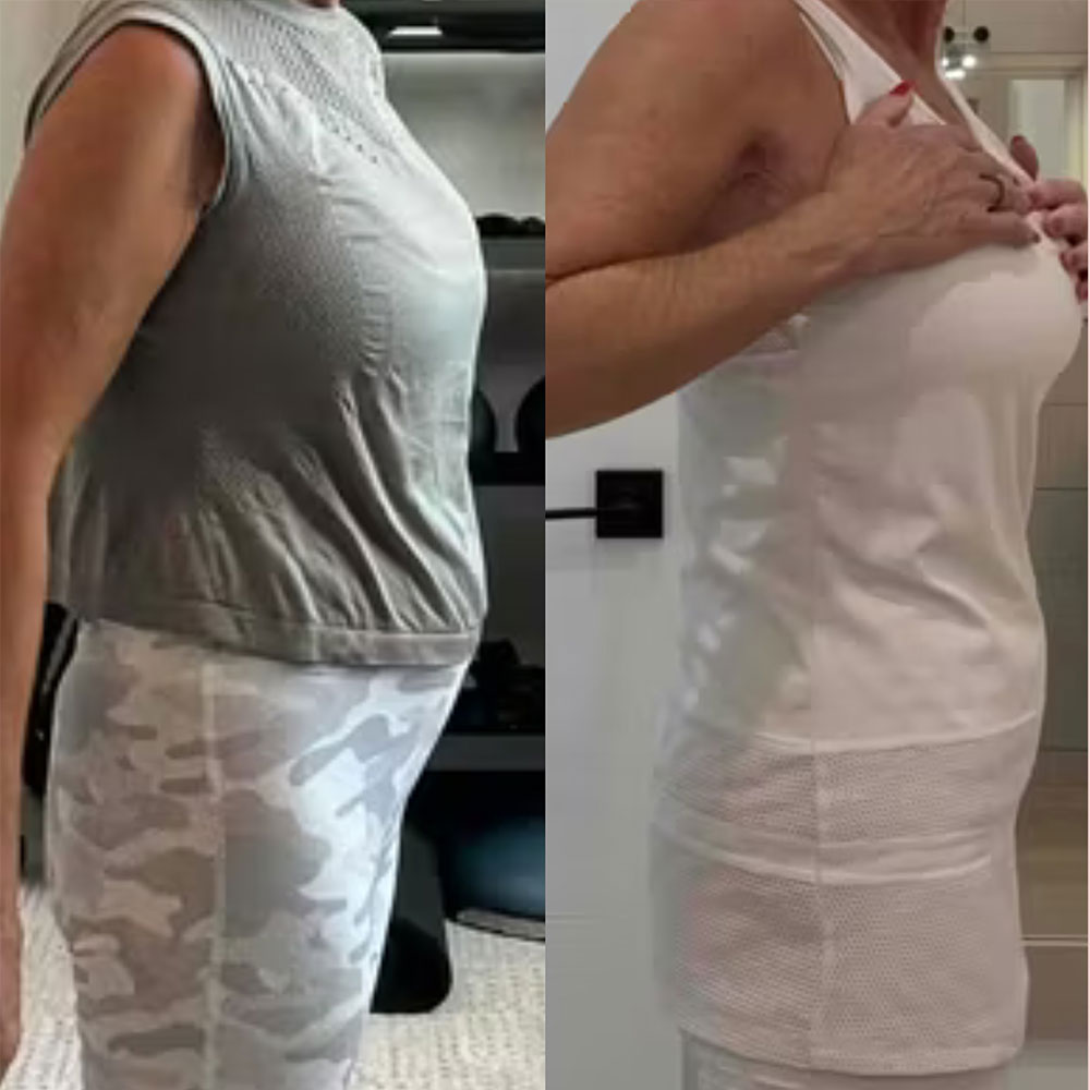 Transformation 3