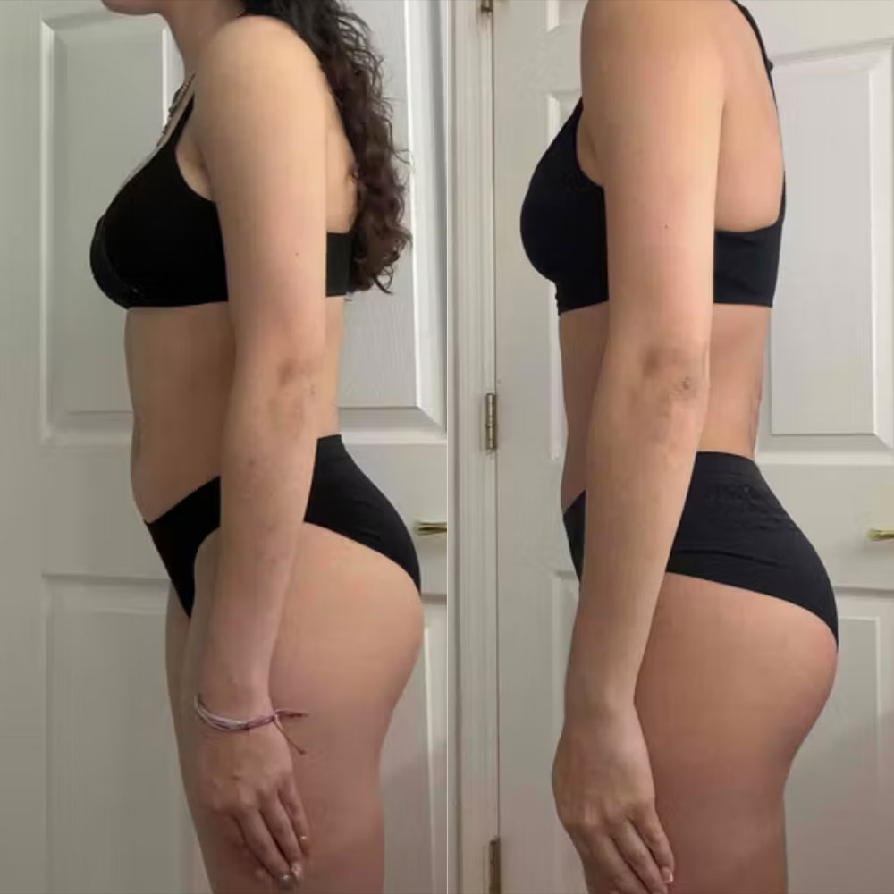 Transformation 1
