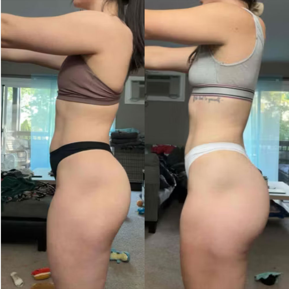 Transformation 4
