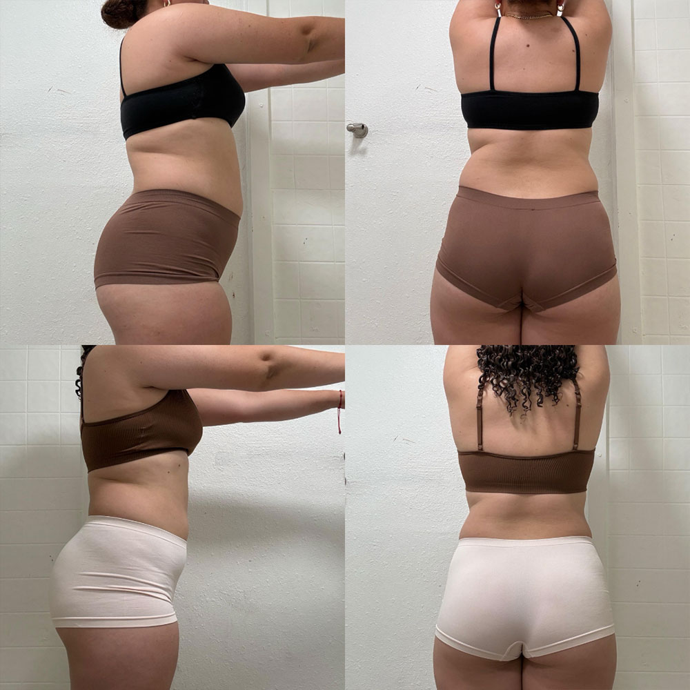 Transformation 2