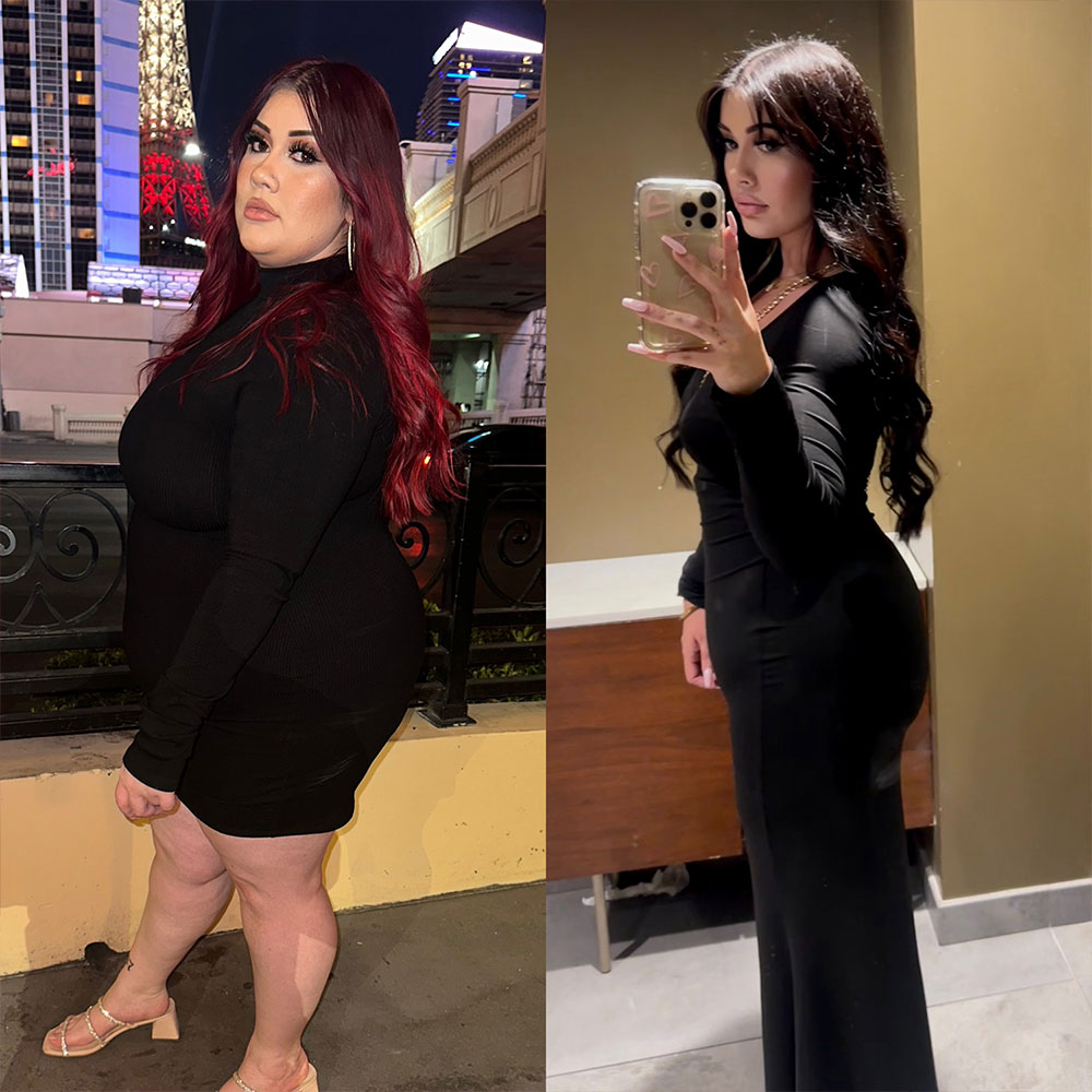 Transformation 4