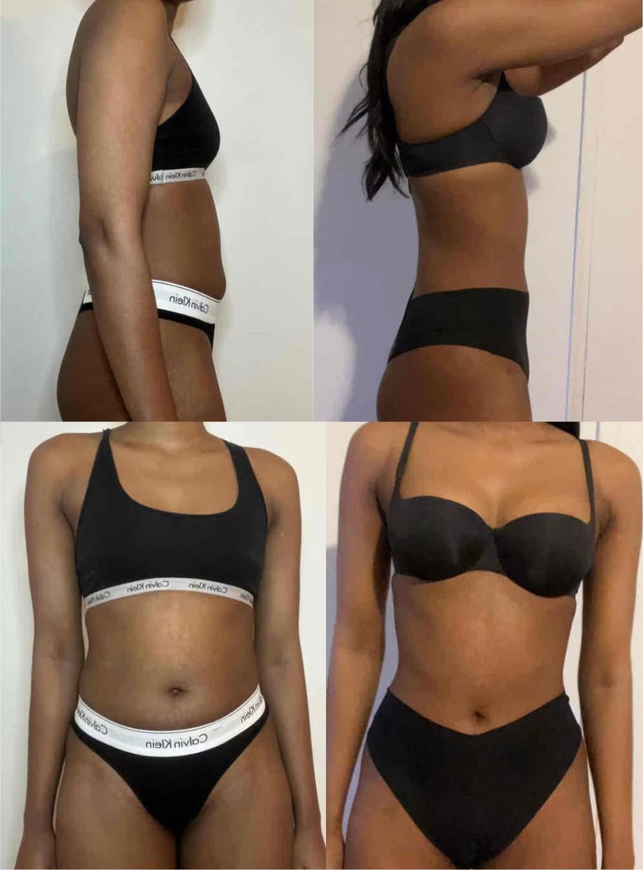 Transformation 1