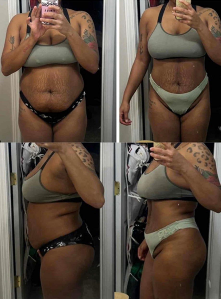 Transformation 3