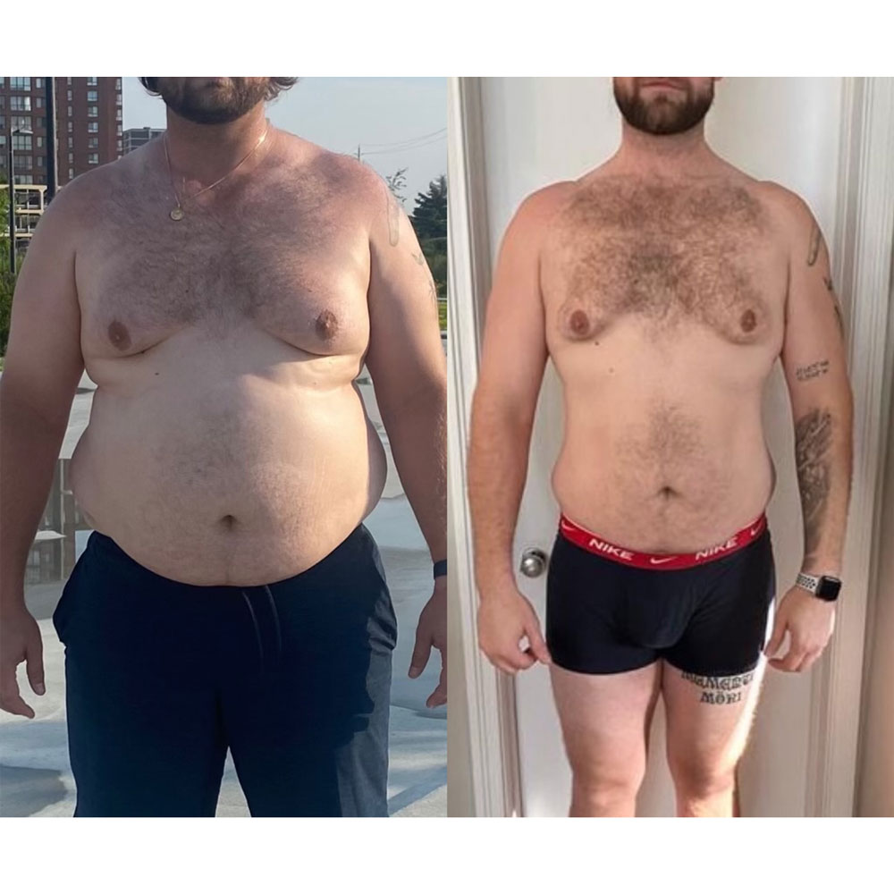 Transformation 3