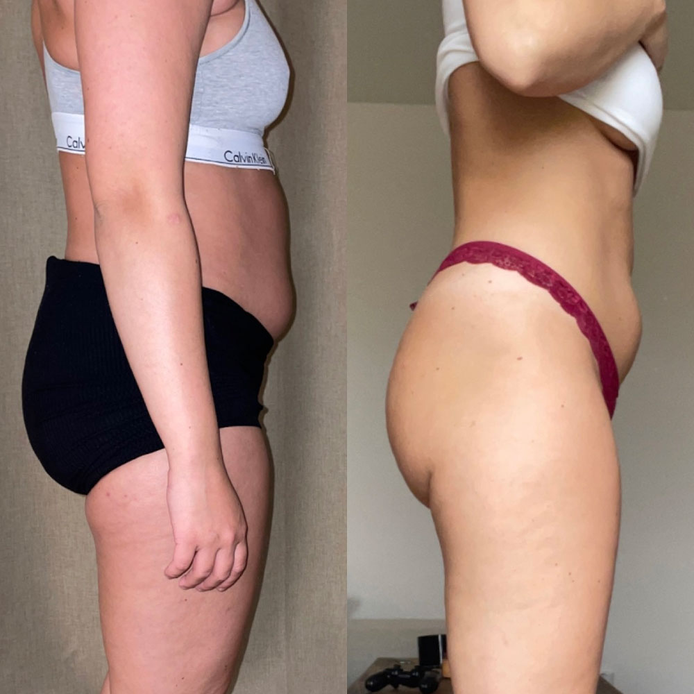 Transformation 4