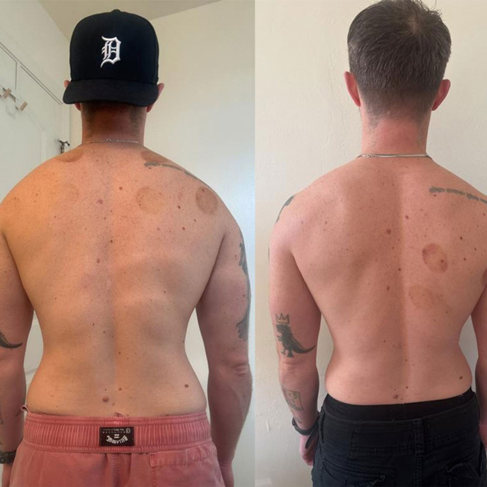 Transformation 5