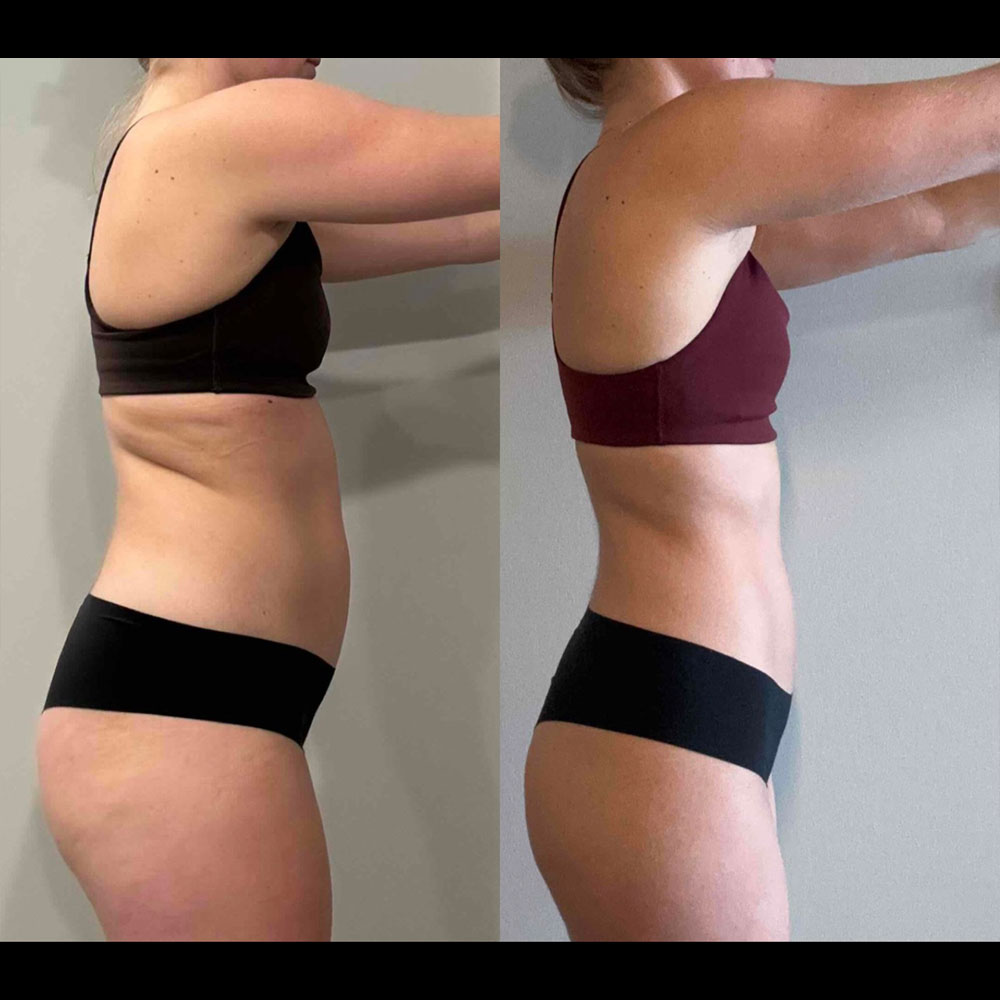 Transformation 1