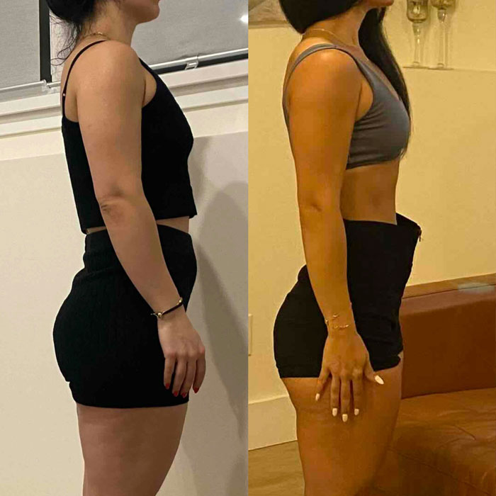 Transformation 3
