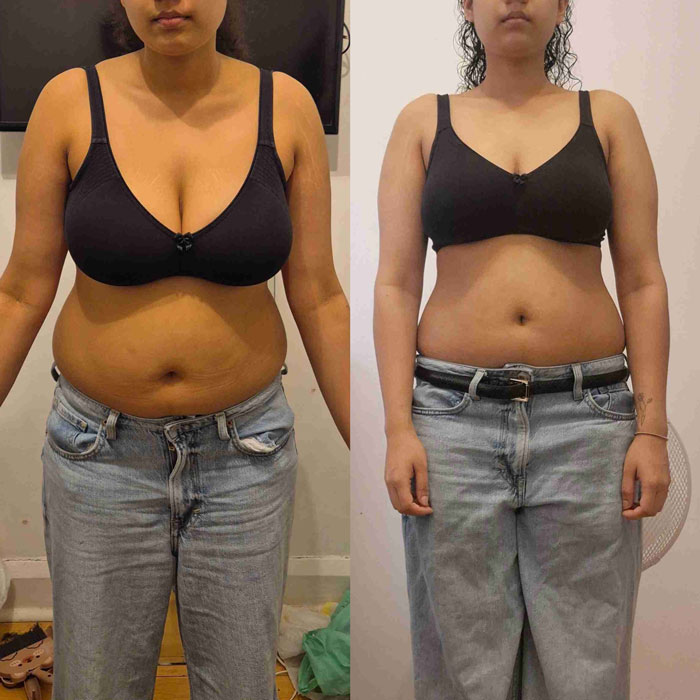 Transformation 1