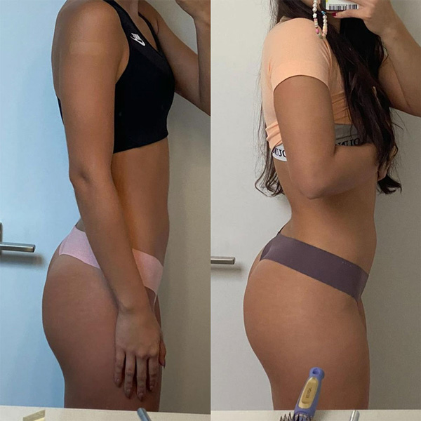 Transformation 1