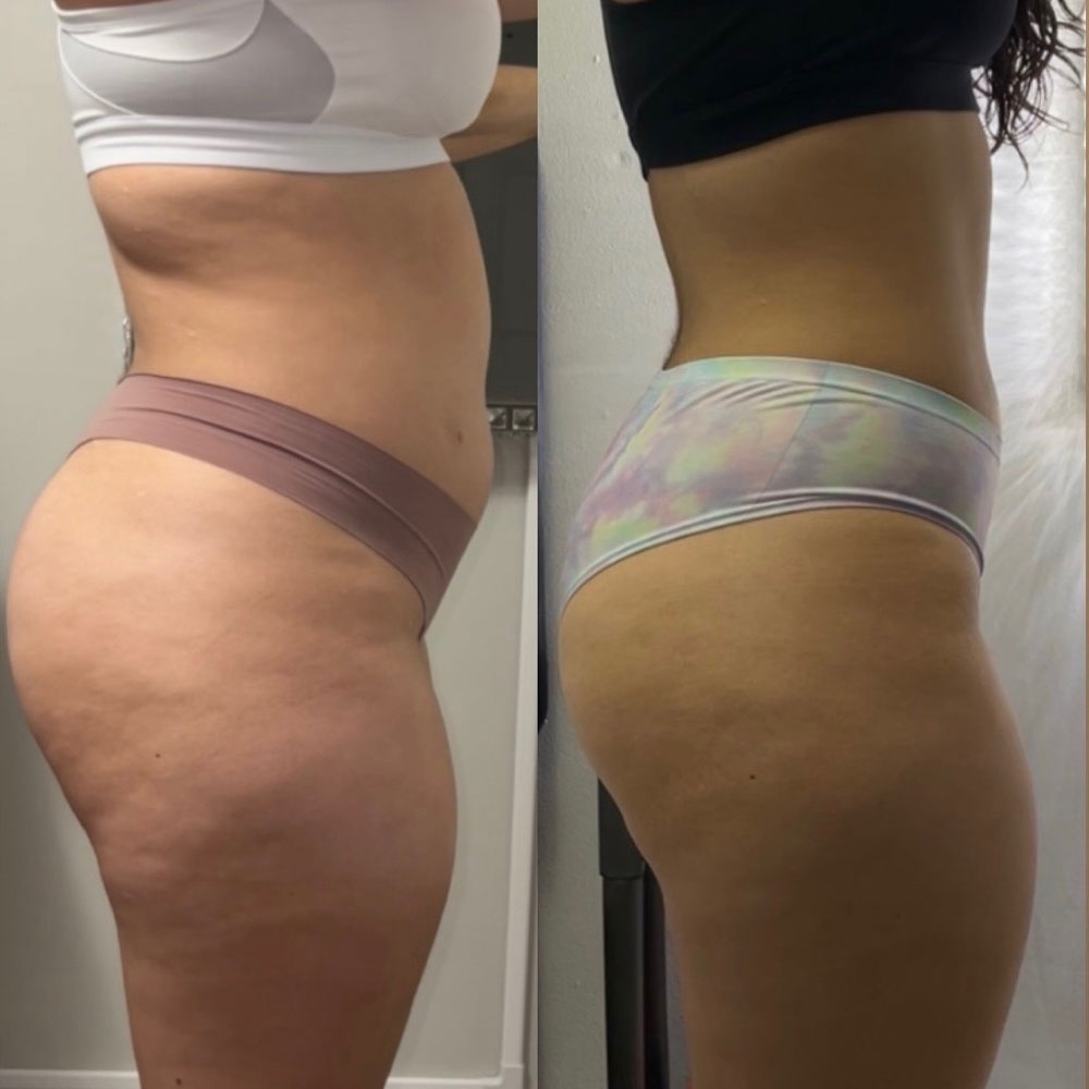 Transformation 5