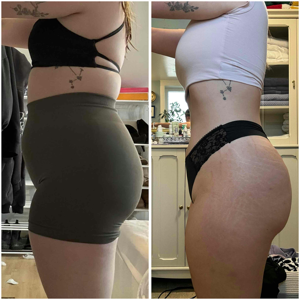 Transformation 2