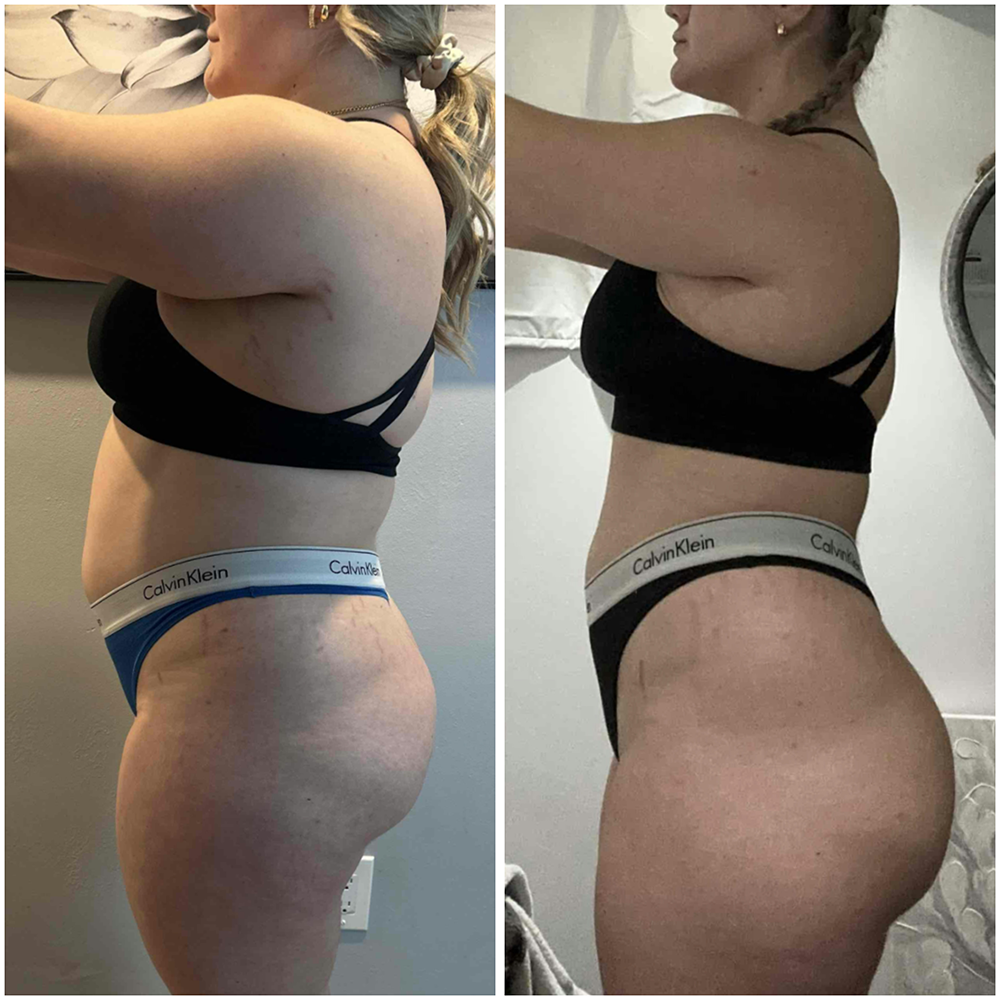 Transformation 1