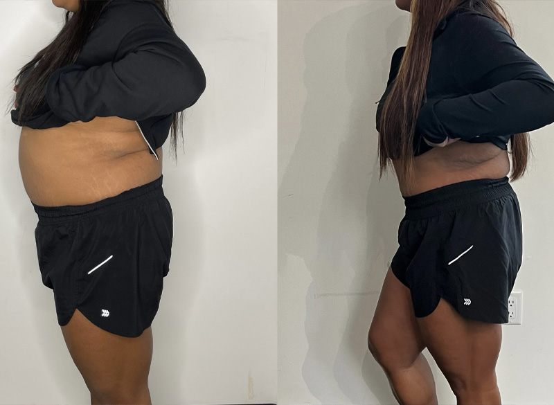Transformation 1
