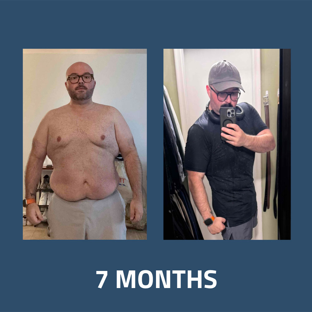 Transformation 4
