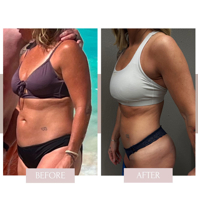 Transformation 3